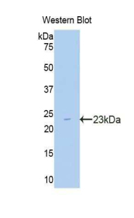 CPT1A Antibody - Western blot of recombinant CPT1 / CPT1A.  This image was taken for the unconjugated form of this product. Other forms have not been tested.