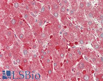 CPT1A Antibody - Human Liver: Formalin-Fixed, Paraffin-Embedded (FFPE).  This image was taken for the unconjugated form of this product. Other forms have not been tested.