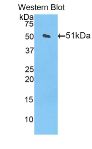 CPT1A Antibody - Western blot of recombinant CPT1 / CPT1A.  This image was taken for the unconjugated form of this product. Other forms have not been tested.