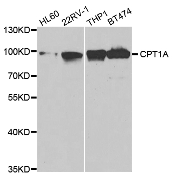 CPT1A Antibody - Western blot analysis of extracts of various cell lines, using CPT1A antibody.