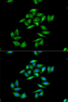 CPT1A Antibody - Immunofluorescence analysis of MCF-7 cell using CPT1A antibody. Blue: DAPI for nuclear staining.