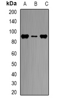 CPT1A Antibody - Western blot analysis of CPT1A expression in HL60 (A); THP1 (B); BT474 (C) whole cell lysates.