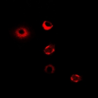 CPT1A Antibody - Immunofluorescent analysis of CPT1A staining in MCF7 cells. Formalin-fixed cells were permeabilized with 0.1% Triton X-100 in TBS for 5-10 minutes and blocked with 3% BSA-PBS for 30 minutes at room temperature. Cells were probed with the primary antibody in 3% BSA-PBS and incubated overnight at 4 deg C in a humidified chamber. Cells were washed with PBST and incubated with a DyLight 594-conjugated secondary antibody (red) in PBS at room temperature in the dark.