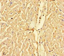 CPT1A Antibody - Immunohistochemistry of paraffin-embedded human heart tissue at dilution of 1:100