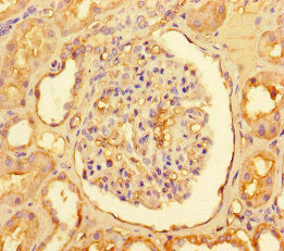 CPT1A Antibody - Immunohistochemistry of paraffin-embedded human kidney tissue at dilution of 1:100