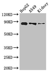 CPT1A Antibody - Western Blot Positive WB detected in:HepG2 whole cell lysate,A549 whole cell lysate,Mouse kidney tissue All Lanes: CPT1A antibody at 3.4ug/ml Secondary Goat polyclonal to rabbit IgG at 1/50000 dilution Predicted band size: 89,87 kDa Observed band size: 89 kDa