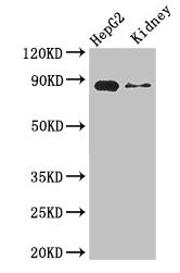 CPT1A Antibody - Western Blot Positive WB detected in: HepG2 whole cell lysate, Mouse kidney tissue All lanes: CPT1A antibody at 3.4µg/ml Secondary Goat polyclonal to rabbit IgG at 1/50000 dilution Predicted band size: 89, 87 kDa Observed band size: 89 kDa
