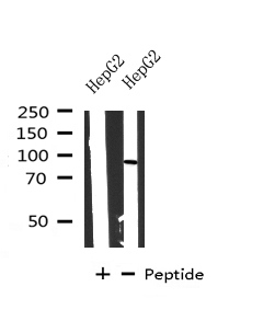 CPT1A Antibody - Western blot analysis on HepG2 cell lysates using CPT1A antibody