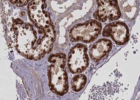 CPT1A Antibody - 1:100 staining human kidney tissue by IHC-P. The tissue was formaldehyde fixed and a heat mediated antigen retrieval step in citrate buffer was performed. The tissue was then blocked and incubated with the antibody for 1.5 hours at 22°C. An HRP conjugated goat anti-rabbit antibody was used as the secondary.