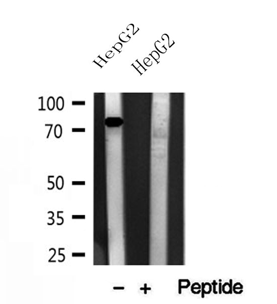 CPT1A Antibody - Western blot analysis of extracts of HepG2 cells using CPT1A antibody.