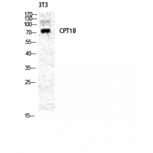 CPT1B Antibody - Western blot of CPTI-M antibody