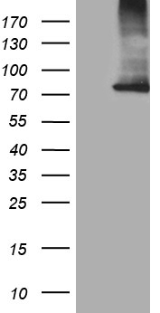 CPT1B Antibody - HEK293T cells were transfected with the pCMV6-ENTRY control. (Left lane) or pCMV6-ENTRY CPT1B. (Right lane) cDNA for 48 hrs and lysed. Equivalent amounts of cell lysates. (5 ug per lane) were separated by SDS-PAGE and immunoblotted with anti-CPT1B. (1:2000)