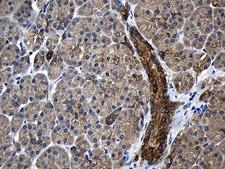 CPT1B Antibody - Immunohistochemical staining of paraffin-embedded Human pancreas tissue within the normal limits using anti-CPT1B mouse monoclonal antibody. (Heat-induced epitope retrieval by 1mM EDTA in 10mM Tris buffer. (pH8.5) at 120°C for 3 min. (1:500)
