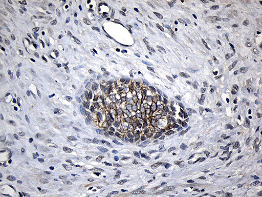 CPT1B Antibody - Immunohistochemical staining of paraffin-embedded Human prostate tissue within the normal limits using anti-CPT1B mouse monoclonal antibody. (Heat-induced epitope retrieval by 1mM EDTA in 10mM Tris buffer. (pH8.5) at 120°C for 3 min. (1:500)