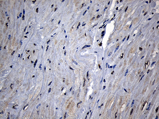 CPT1B Antibody - Immunohistochemical staining of paraffin-embedded Human bladder tissue within the normal limits using anti-CPT1B mouse monoclonal antibody. (Heat-induced epitope retrieval by 1mM EDTA in 10mM Tris buffer. (pH8.5) at 120°C for 3 min. (1:500)