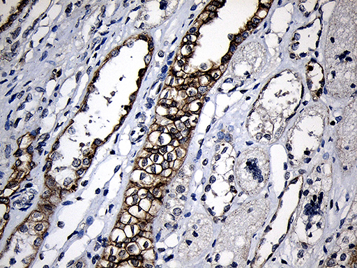 CPT1B Antibody - Immunohistochemical staining of paraffin-embedded Human Kidney tissue within the normal limits using anti-CPT1B mouse monoclonal antibody. (Heat-induced epitope retrieval by 1mM EDTA in 10mM Tris buffer. (pH8.5) at 120°C for 3 min. (1:500)