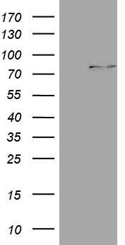 CPT1B Antibody - HEK293T cells were transfected with the pCMV6-ENTRY control. (Left lane) or pCMV6-ENTRY CPT1B. (Right lane) cDNA for 48 hrs and lysed