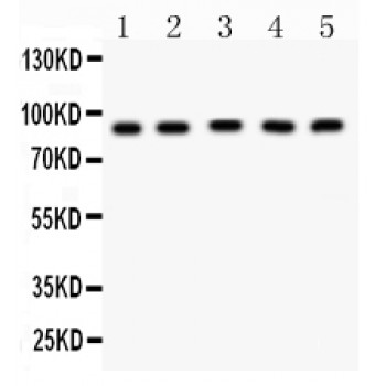 CPT1B Antibody - CPT1B antibody Western blot. All lanes: Anti CPT1B at 0.5 ug/ml. Lane 1: Rat Skeletal Muscle Tissue Lysate at 50 ug. Lane 2: Rat Cardiac Muscle Tissue Lysate at 50 ug. Lane 3: Mouse Skeletal Muscle Tissue Lysate at 50 ug. Lane 4: Mouse Cardiac Muscle Tissue Lysate at 50 ug. Lane 5: HELA Whole Cell Lysate at 40 ug. Predicted band size: 88 kD. Observed band size: 88 kD.