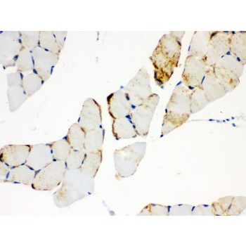 CPT1B Antibody - CPT1B antibody IHC-paraffin. IHC(P): Mouse Skeletal Muscle Tissue.