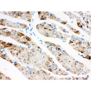 CPT1B Antibody - CPT1B antibody IHC-paraffin. IHC(P): Rat Cardiac Muscle Tissue.