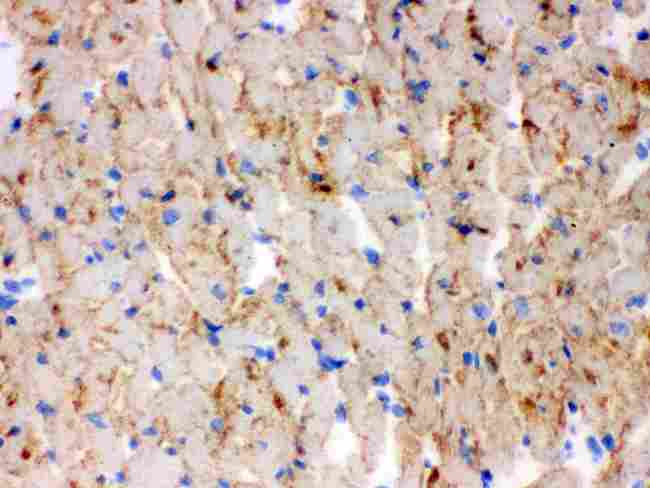 CPT1B Antibody - IHC analysis of CPT1B using anti-CPT1B antibody. CPT1B was detected in frozen section of mouse cardiac muscle tissue. Heat mediated antigen retrieval was performed in citrate buffer (pH6, epitope retrieval solution) for 20 mins. The tissue section was blocked with 10% goat serum. The tissue section was then incubated with 1µg/ml rabbit anti-CPT1B Antibody overnight at 4°C. Biotinylated goat anti-rabbit IgG was used as secondary antibody and incubated for 30 minutes at 37°C. The tissue section was developed using Strepavidin-Biotin-Complex (SABC) with DAB as the chromogen.