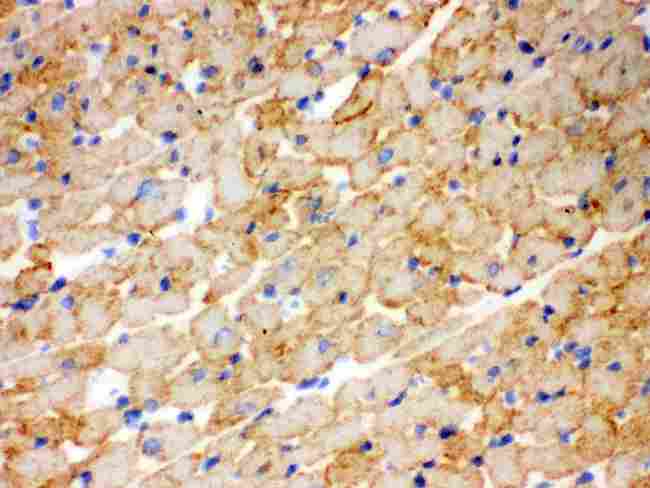 CPT1B Antibody - IHC analysis of CPT1B using anti-CPT1B antibody. CPT1B was detected in frozen section of rat cardiac muscle tissue. Heat mediated antigen retrieval was performed in citrate buffer (pH6, epitope retrieval solution) for 20 mins. The tissue section was blocked with 10% goat serum. The tissue section was then incubated with 1µg/ml rabbit anti-CPT1B Antibody overnight at 4°C. Biotinylated goat anti-rabbit IgG was used as secondary antibody and incubated for 30 minutes at 37°C. The tissue section was developed using Strepavidin-Biotin-Complex (SABC) with DAB as the chromogen.