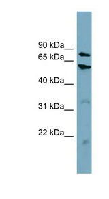 CPT1B Antibody - CPT1B antibody Western blot of HT1080 cell lysate. This image was taken for the unconjugated form of this product. Other forms have not been tested.