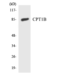 CPT1B Antibody - Western blot analysis of the lysates from HepG2 cells using CPT1B antibody.