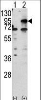 CPT1B Antibody - Western blot of CPT1B (arrow) using rabbit polyclonal CPT1B Antibody. 293 cell lysates (2 ug/lane) either nontransfected (Lane 1) or transiently transfected with the CPT1B gene (Lane 2).