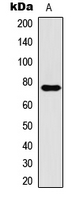 CPT1B Antibody - Western blot analysis of CPT1B expression in HT1080 (A) whole cell lysates.