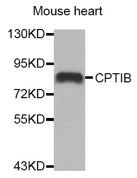 CPT1B Antibody - Western blot analysis of extracts of Mouse heart tissue, using CPT1B antibody.
