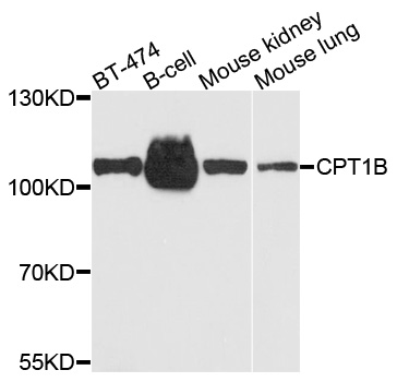 CPT1B Antibody - Western blot analysis of extracts of various cells.