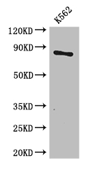 CPT1B Antibody - Positive WB detected in:K562 whole cell lysate;All lanes: CPT1B antibody at 3.4ug/ml;Secondary;Goat polyclonal to rabbit IgG at 1/50000 dilution;Predicted band size: 88,67,84,79 kDa;Observed band size: 88 kDa;