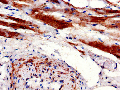 CPT1B Antibody - Immunohistochemistry of paraffin-embedded human heart tissue using CPT1B Antibody at dilution of 1:100