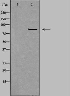 CPT1B Antibody - Western blot analysis of extracts of HepG2 cells using CPT1B antibody. The lane on the left is treated with the antigen-specific peptide.