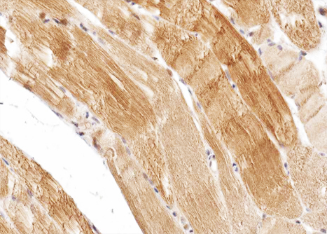 CPT1B Antibody - 1:100 staining human skeletal muscle tissue by IHC-P. The tissue was formaldehyde fixed and a heat mediated antigen retrieval step in citrate buffer was performed. The tissue was then blocked and incubated with the antibody for 1.5 hours at 22°C. An HRP conjugated goat anti-rabbit antibody was used as the secondary.