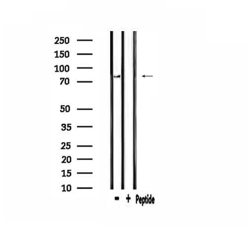 CPT1B Antibody - Western blot analysis of extracts of 293 cells using CPT1B antibody.