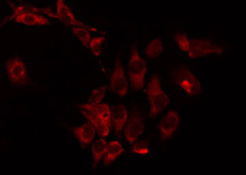 CPT1B Antibody - Staining HepG2 cells by IF/ICC. The samples were fixed with PFA and permeabilized in 0.1% Triton X-100, then blocked in 10% serum for 45 min at 25°C. The primary antibody was diluted at 1:200 and incubated with the sample for 1 hour at 37°C. An Alexa Fluor 594 conjugated goat anti-rabbit IgG (H+L) Ab, diluted at 1/600, was used as the secondary antibody.