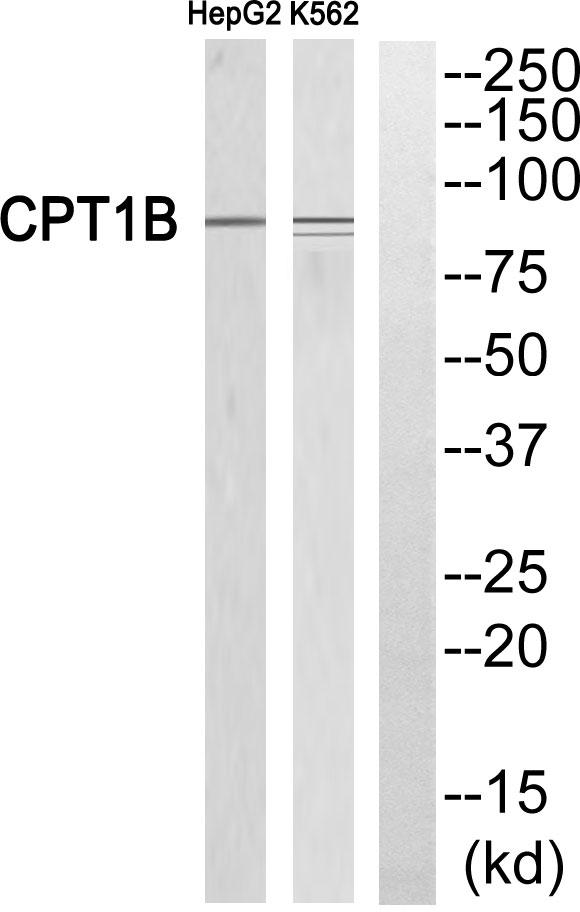 CPT1B Antibody - Western blot analysis of extracts from HepG2 cells and K562 cells, using CPT1B antibody.