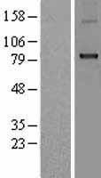 CPT1B Protein - Western validation with an anti-DDK antibody * L: Control HEK293 lysate R: Over-expression lysate