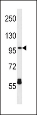 CPT1C Antibody - CPT1C Antibody western blot of HL-60 cell line lysates (35 ug/lane). The CPT1C antibody detected the CPT1C protein (arrow).