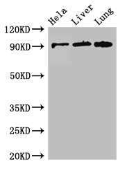 CPT1C Antibody - Positive WB detected in:Hela whole cell lysate,Mouse liver tissue,Mouse lung tissue;All lanes:CPT1C antibody at 2.6?g/ml;Secondary;Goat polyclonal to rabbit IgG at 1/50000 dilution;Predicted band size: 91,90,80 KDa;Observed band size: 91 KDa;