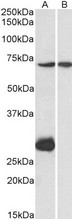 CPT2 Antibody - Goat Anti-CPT2 (aa141-154) Antibody (1?/ml) staining of Mouse Heart (A) and Liver (B) lysate (35? protein in RIPA buffer). Primary incubation was 1 hour. Detected by chemiluminescence.