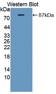 CPT2 Antibody - Western blot of CPT2 antibody.