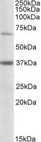 CPT2 Antibody - CPT2 antibody (0.5 ug/ml) staining of Human Liver lysate (35 ug protein in RIPA buffer). Primary incubation was 1 hour. Detected by chemiluminescence.