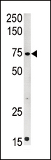 CPT2 Antibody - Western blot of anti-CPT2 antibody in mouse kidney tissue lysate (35 ug/lane). CPT2(arrow) was detected using the purified antibody.