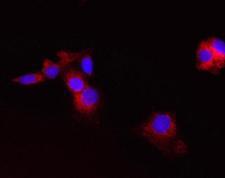 CPT2 Antibody - IF using CPT2 Antibody (1C2AE6)