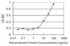 CPT2 Antibody - Detection limit for recombinant GST tagged CPT2 is 0.3 ng/ml as a capture antibody.