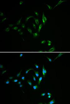 CPT2 Antibody - Immunofluorescence analysis of MCF7 cells.