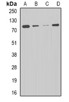 CPT2 Antibody - Western blot analysis of CPT2 expression in HepG2 (A); THP1 (B); mouse liver (C); mouse heart (D) whole cell lysates.